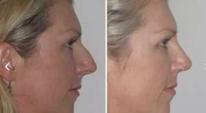Roman - Dr Jeremy Hunt Leading face surgeon